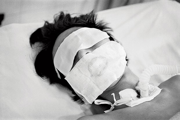 Lynn Johnson’s 2005 photo of a victim of avian flu in Vietnam