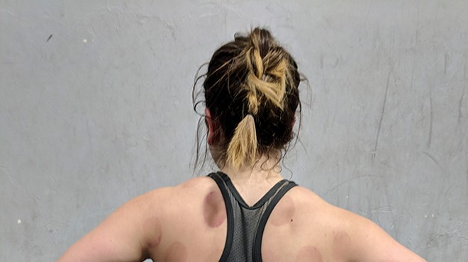Cupping therapy pulls tension up, like the opposite of massage, but in a soothing way