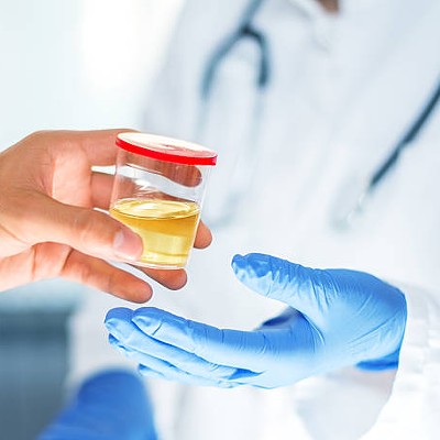 Best Synthetic Urine Kits: 5 Most Effective Fake Pee Products To Pass A Drug Test
