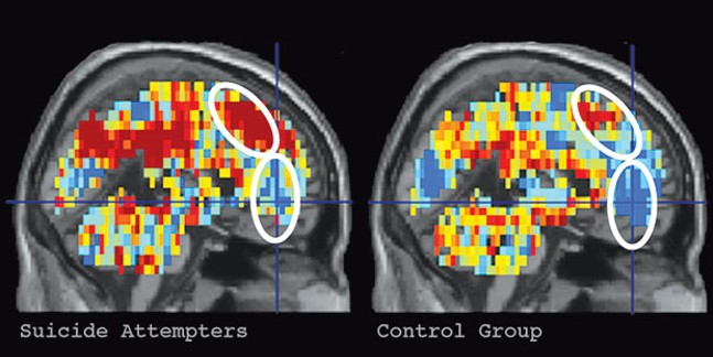 A new study from Pitt and CMU finds that suicidal thoughts may be identifiable using fMRI